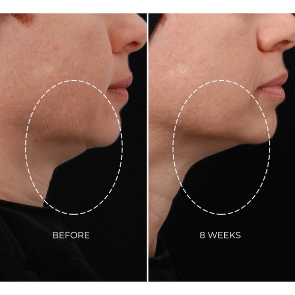 NEWA Classic - Starter Kit NEW IN BOX - Picture 9 of 9